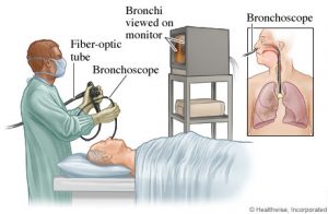 bronchoscopy-webmd